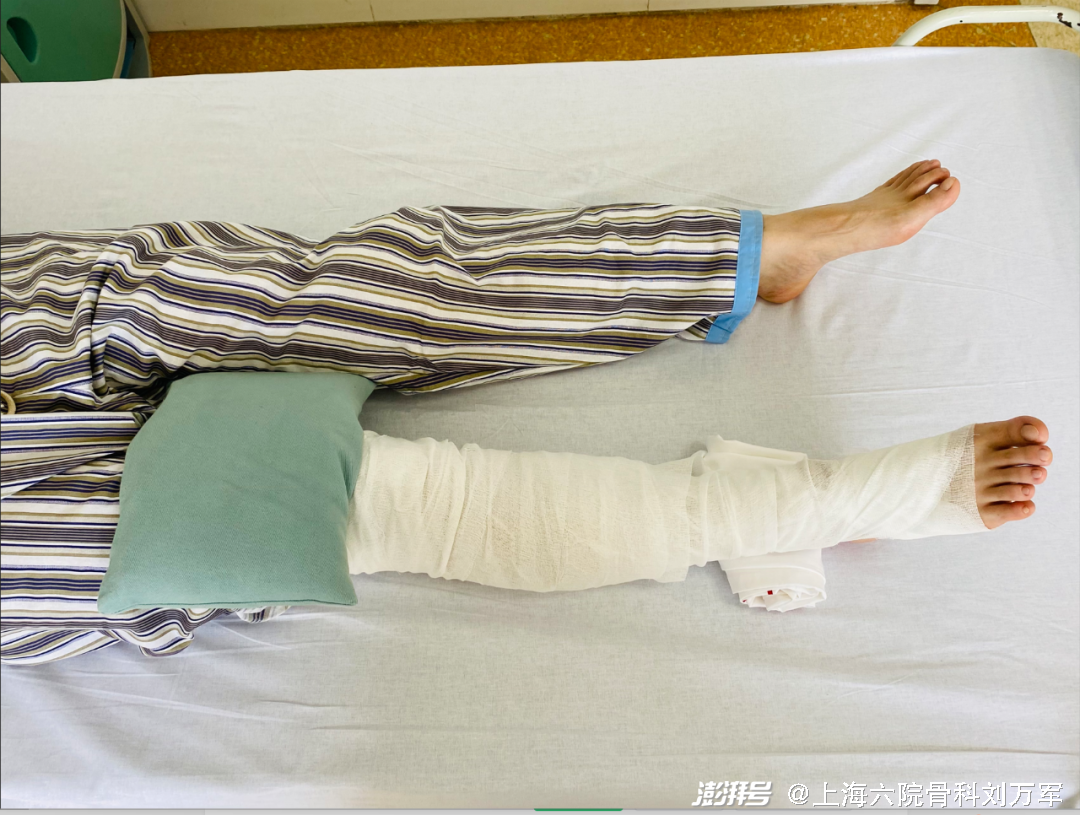 pg网赌软件下载 膝关节置换术后康复训练计划——围手术期