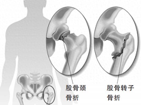 靠墙静蹲可以练大腿肌肉吗_练靠墙静蹲可以瘦腿吗_靠墙静蹲能练出肌肉吗