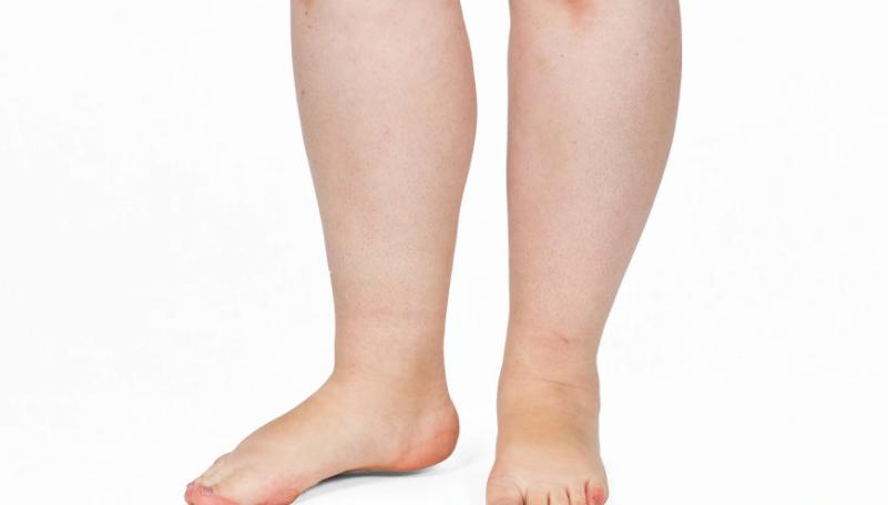 正常人的收缩压是多少?_高血压诊断标准_中老年人血压波动