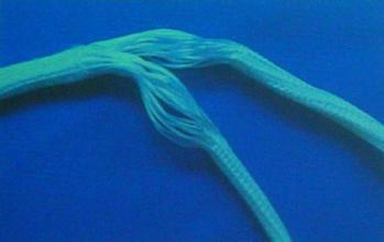 请为我找到交叉韧带康复视频_前交叉韧带康复训练图_交叉韧带运动康复