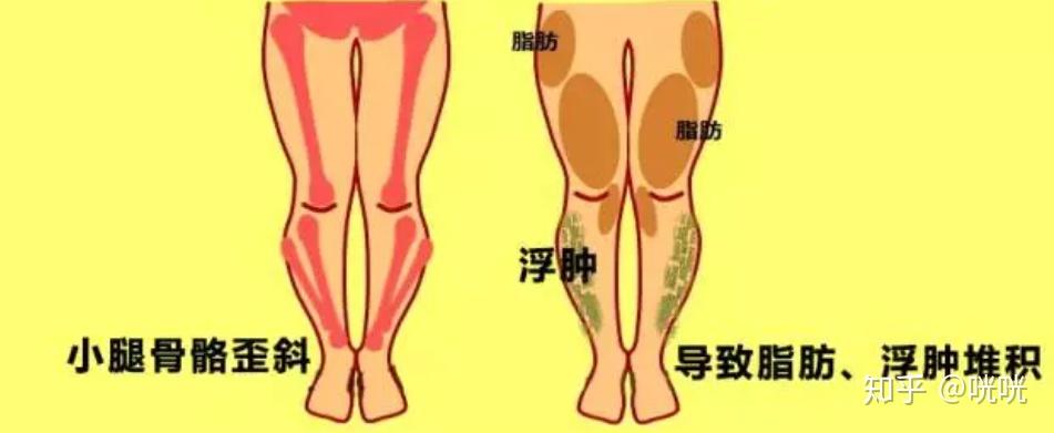 瘦腿操练视频_瘦腿训练方法_脂肪腿改善法