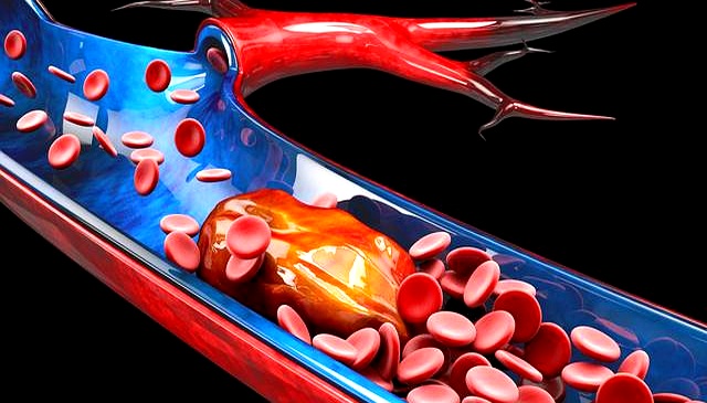 心脏健康_运动前能喝水吗_运动损伤