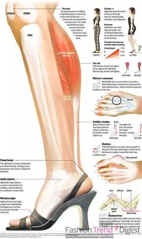 瘦小腿不同类型针对性训练_瘦腿操下载_判断肌肉腿脂肪腿水肿腿