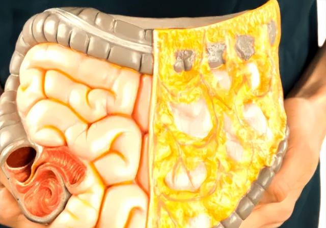 单单靠跑步可以减肚子_减内脏脂肪_抗阻训练