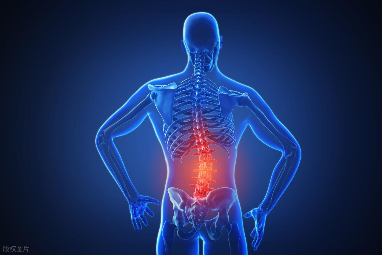 办公室腰间盘突出_长时间窝沙发姿势_腰椎间盘突出不能弯腰