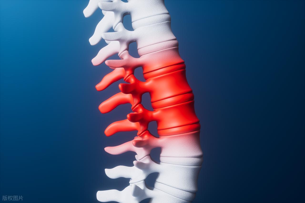 久坐不动腰伤_腰椎间盘突出不能弯腰_腰椎间盘突出坏习惯