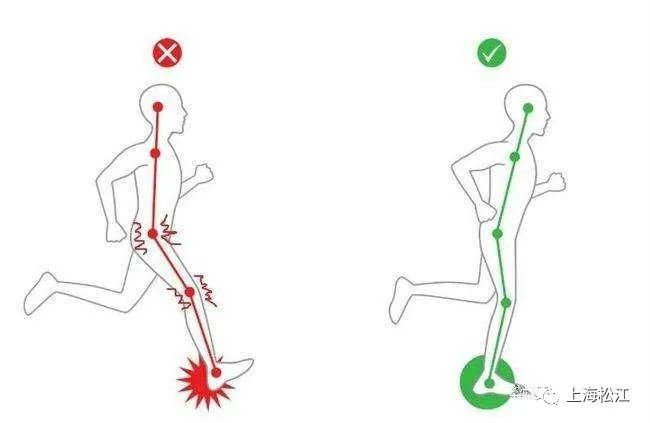 膝盖疼可不可以做深蹲_膝关节损伤运动_膝关节疼痛原因