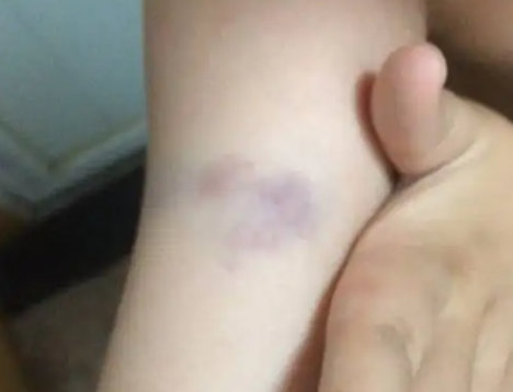 筋膜枪副作用_筋膜枪正确使用方法_综合训练器怎么样贴吧