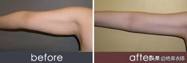 张歆艺产后瘦身秘诀_脚蹬拉力器瘦腰腹训练_陈意涵健身方法